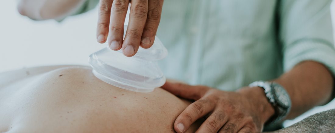 A clients back gets cupping done to it to help ease pain