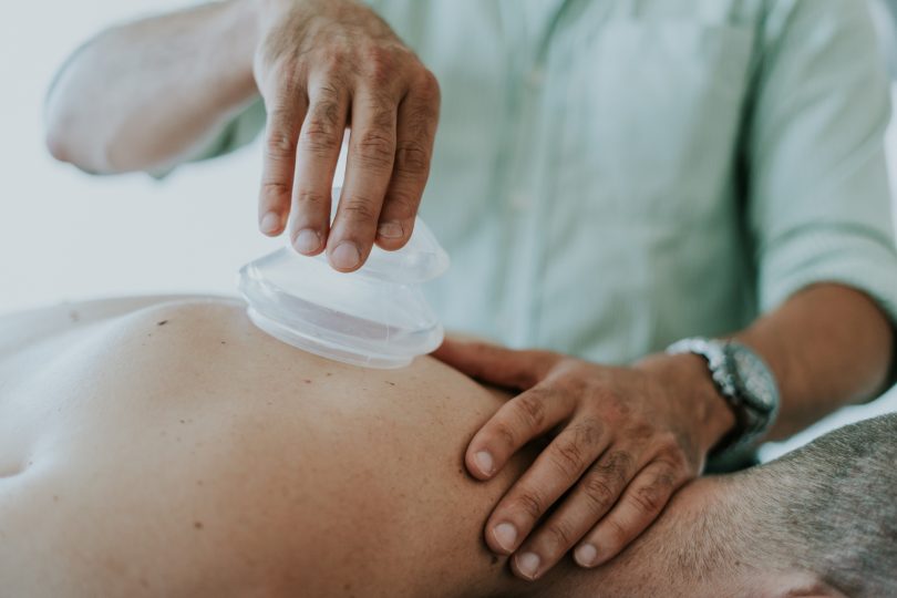 A clients back gets cupping done to it to help ease pain