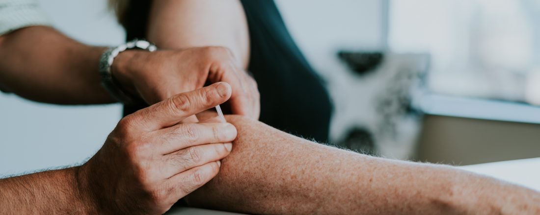 A physio is seen providing IMS to client in a physio clinic